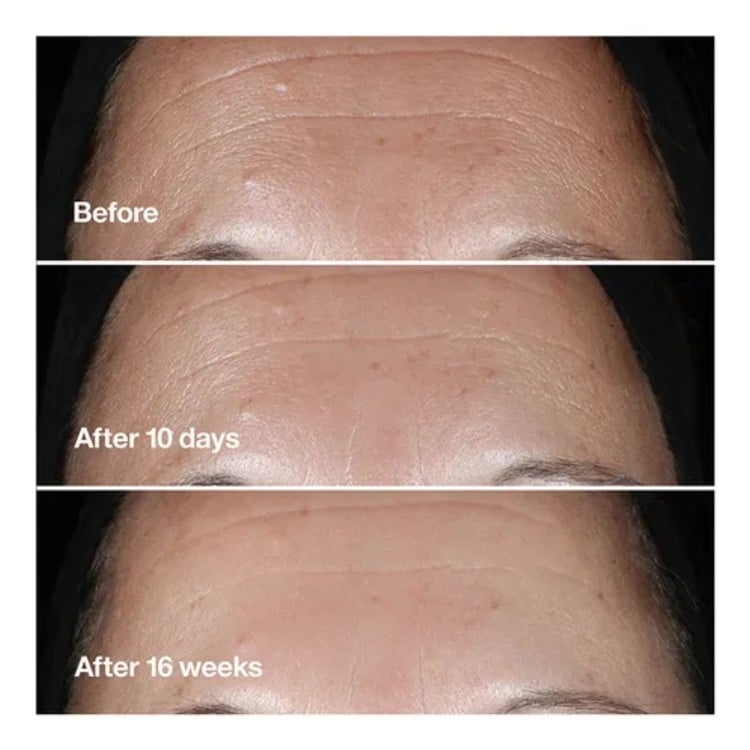 Smart Clinical Repair Wrinkle Correcting Serum • 30ml