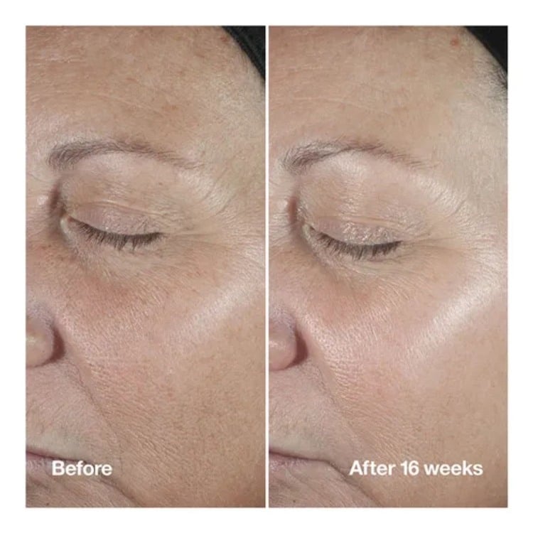 Smart Clinical Repair Wrinkle Correcting Serum • 30ml