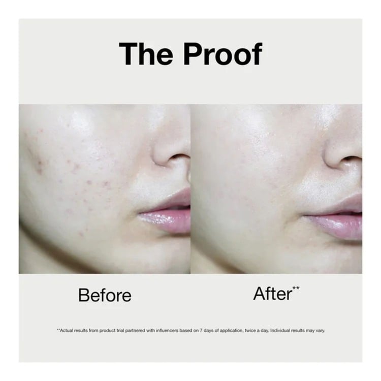Even Better Clinical Radical Dark Spot Corrector + Interrupter Serum • 50ml