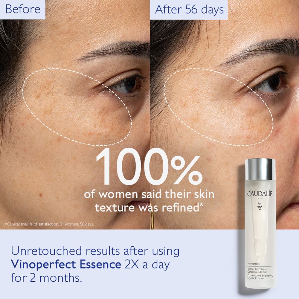 Vinoperfect Concentrated Brightening Glycolic Essence • 150ml