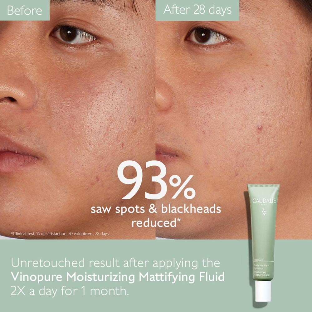 Vinopure Moisturizing Mattifying Fluid • 40ml