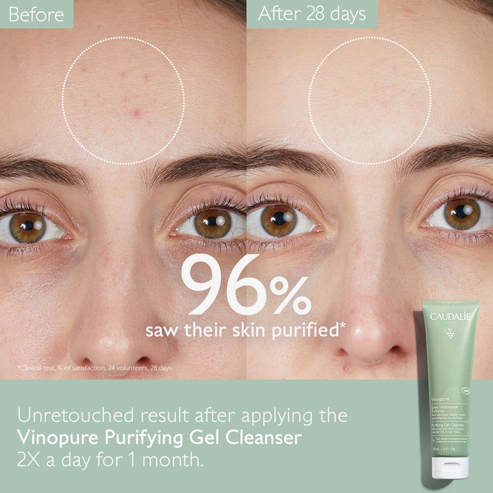 Vinopure Purifying Gel Cleanser • 150ml