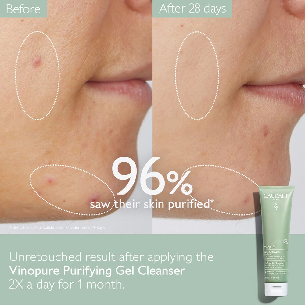 Vinopure Purifying Gel Cleanser • 150ml
