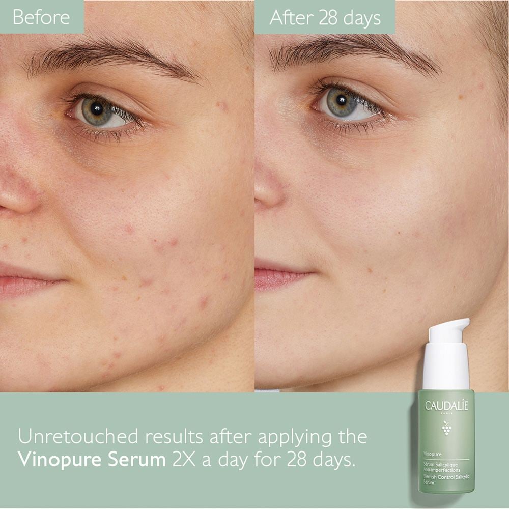 Vinopure Blemish Control Salicylic Serum • 30ml