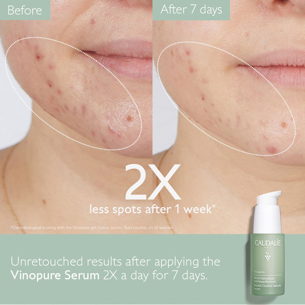 Vinopure Blemish Control Salicylic Serum • 30ml