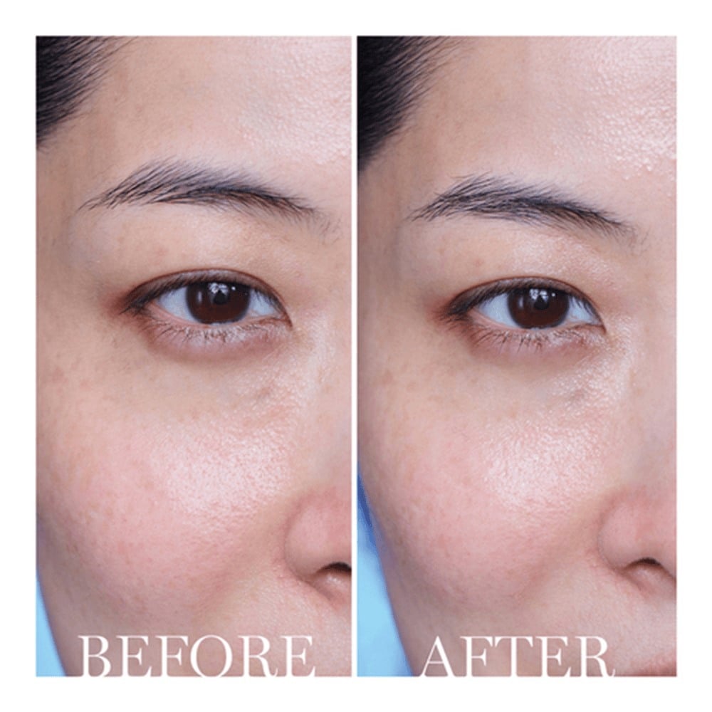 Advanced Génifique Wrinkle & Dark Circle Eye Cream • 15ml