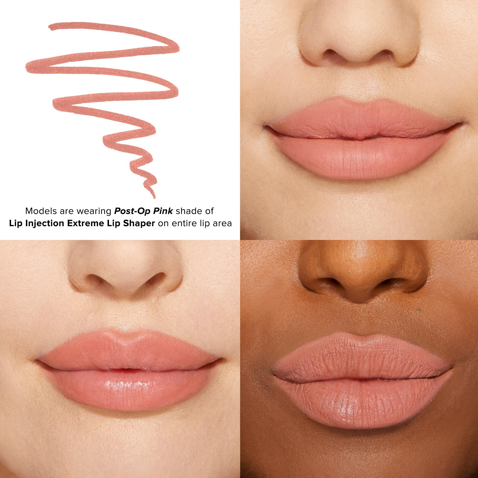 Lip Injection Extreme Lip Shaper •  Post-op Pink