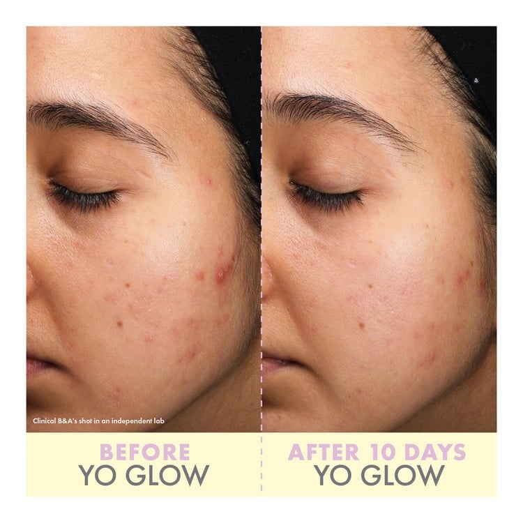 Yo Glow Enzyme Scrub • 40ml