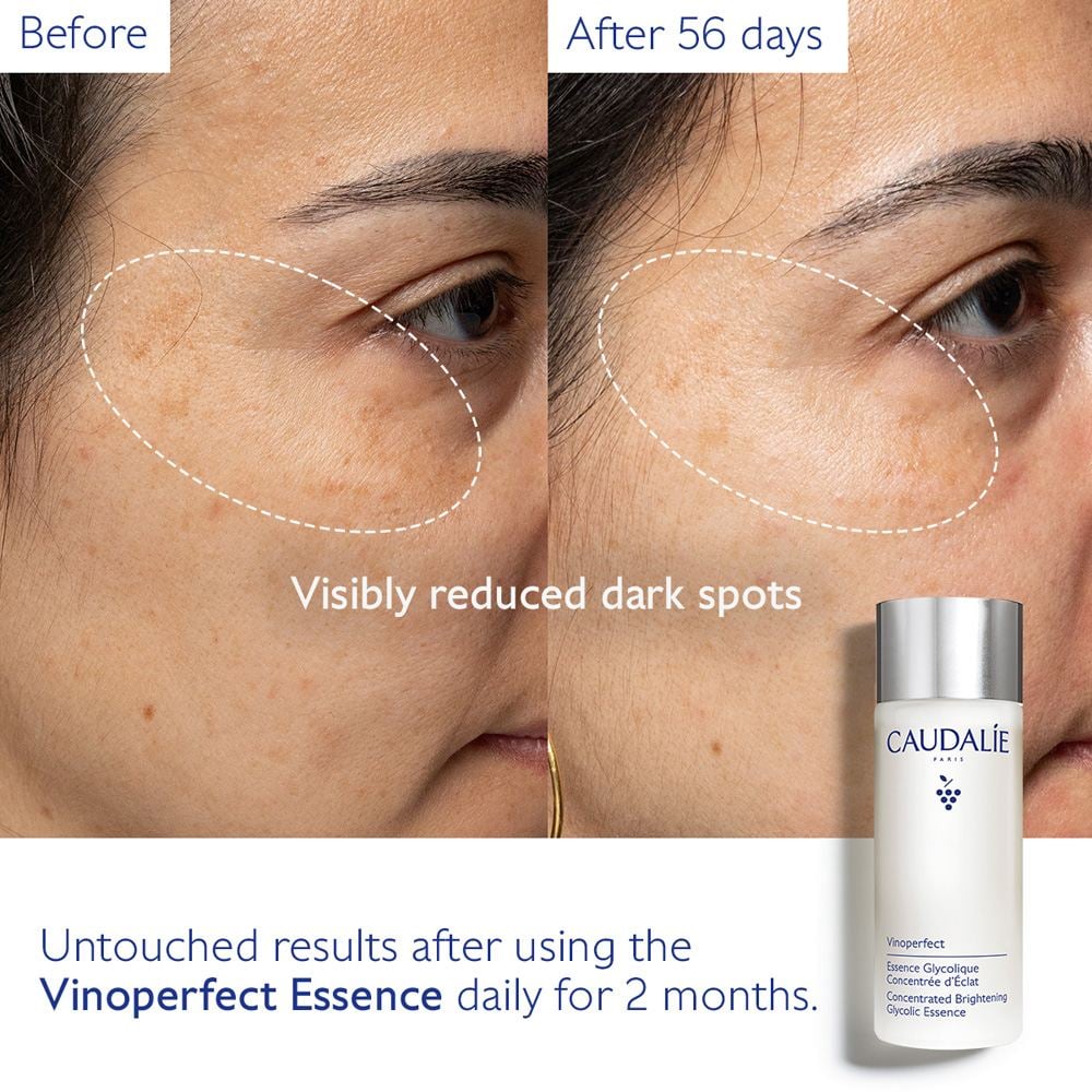 Vinoperfect Concentrated Brightening Glycolic Essence • Value