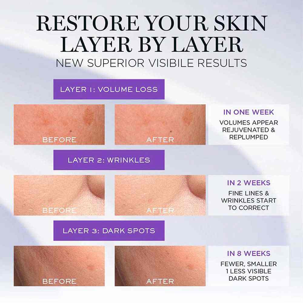 Renergie Ultra Serum • 50ml