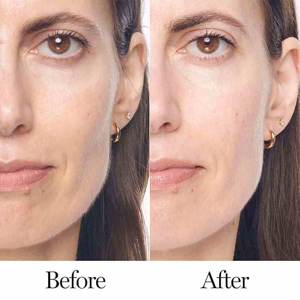 Renergie Ultra Serum • 50ml