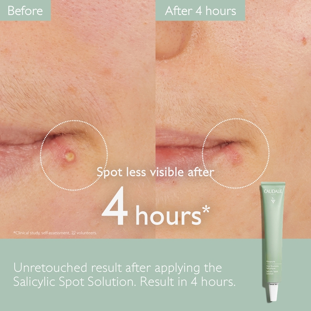 Vinopure Salicylic Spot Solution • 15ml