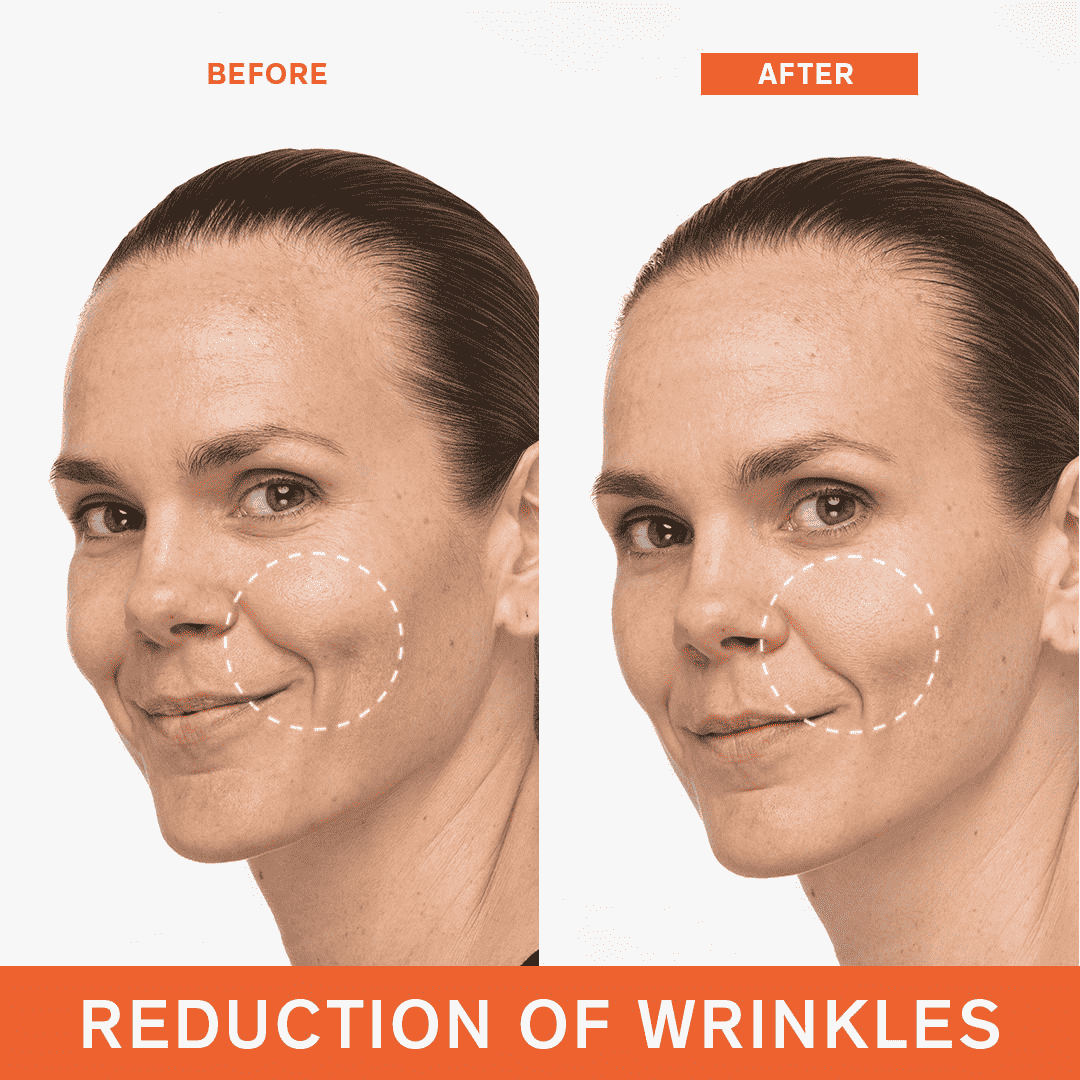 First Care Activating Serum VI • 15ml