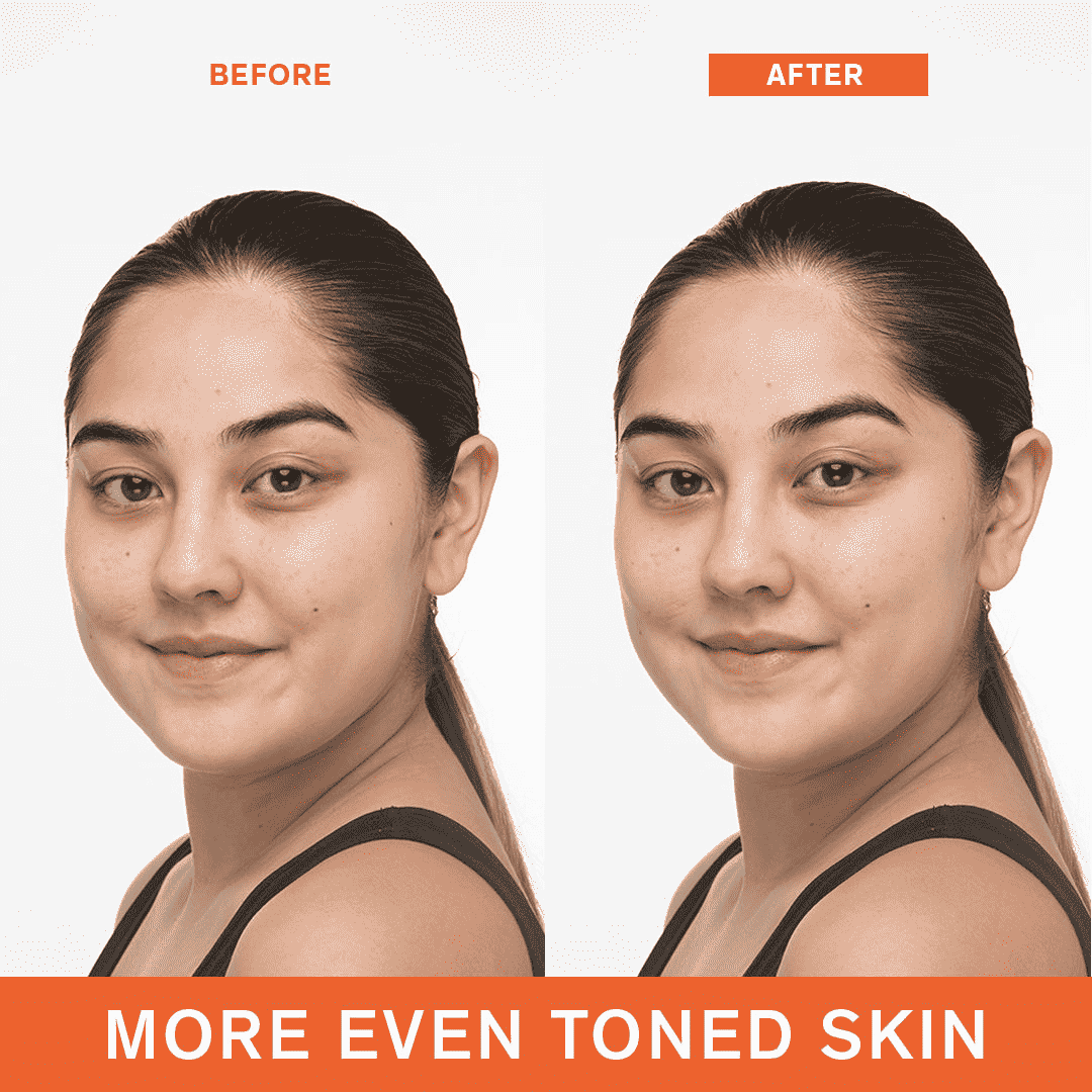 First Care Activating Serum VI • 15ml