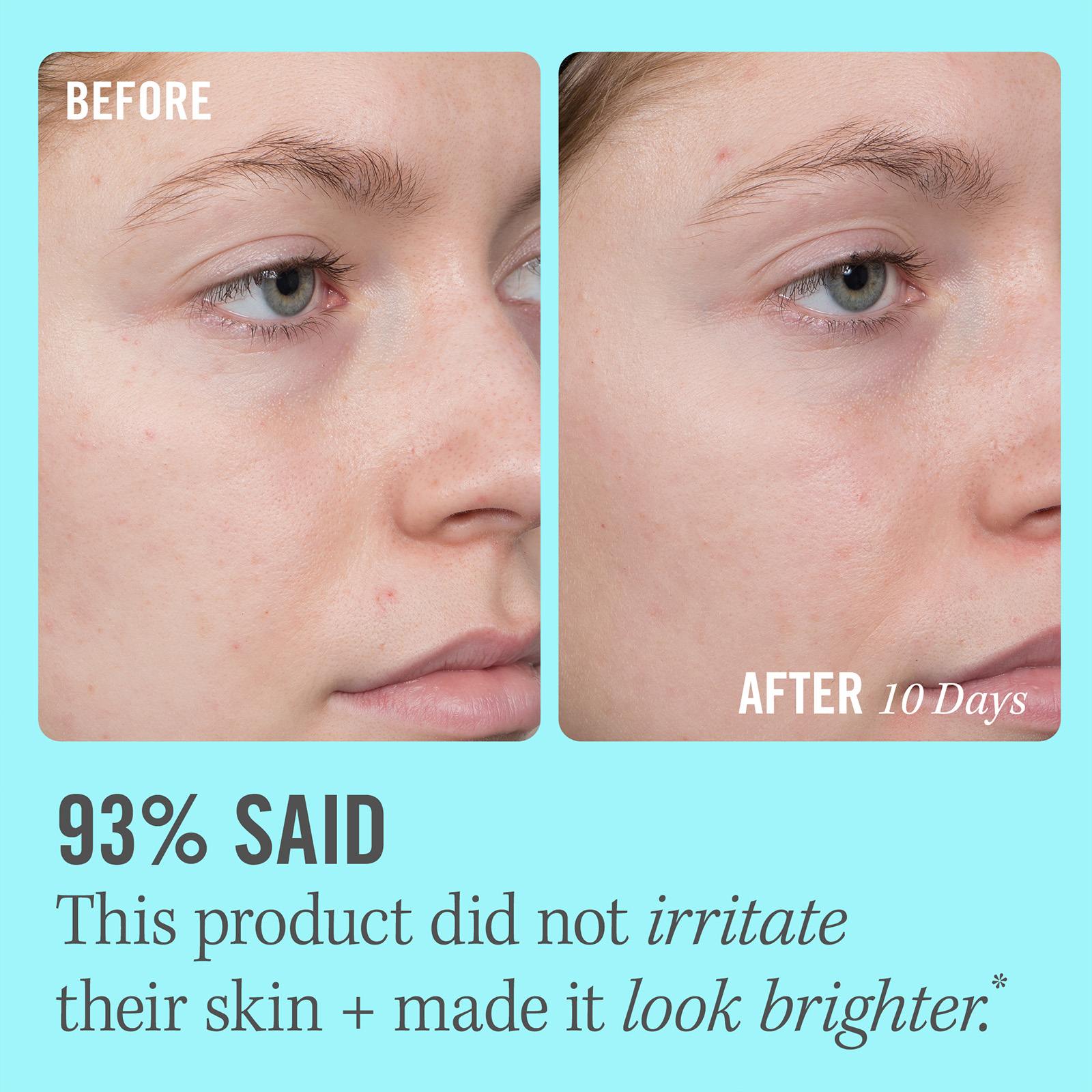 10% Vitamin C Brightening Serum • 50ml