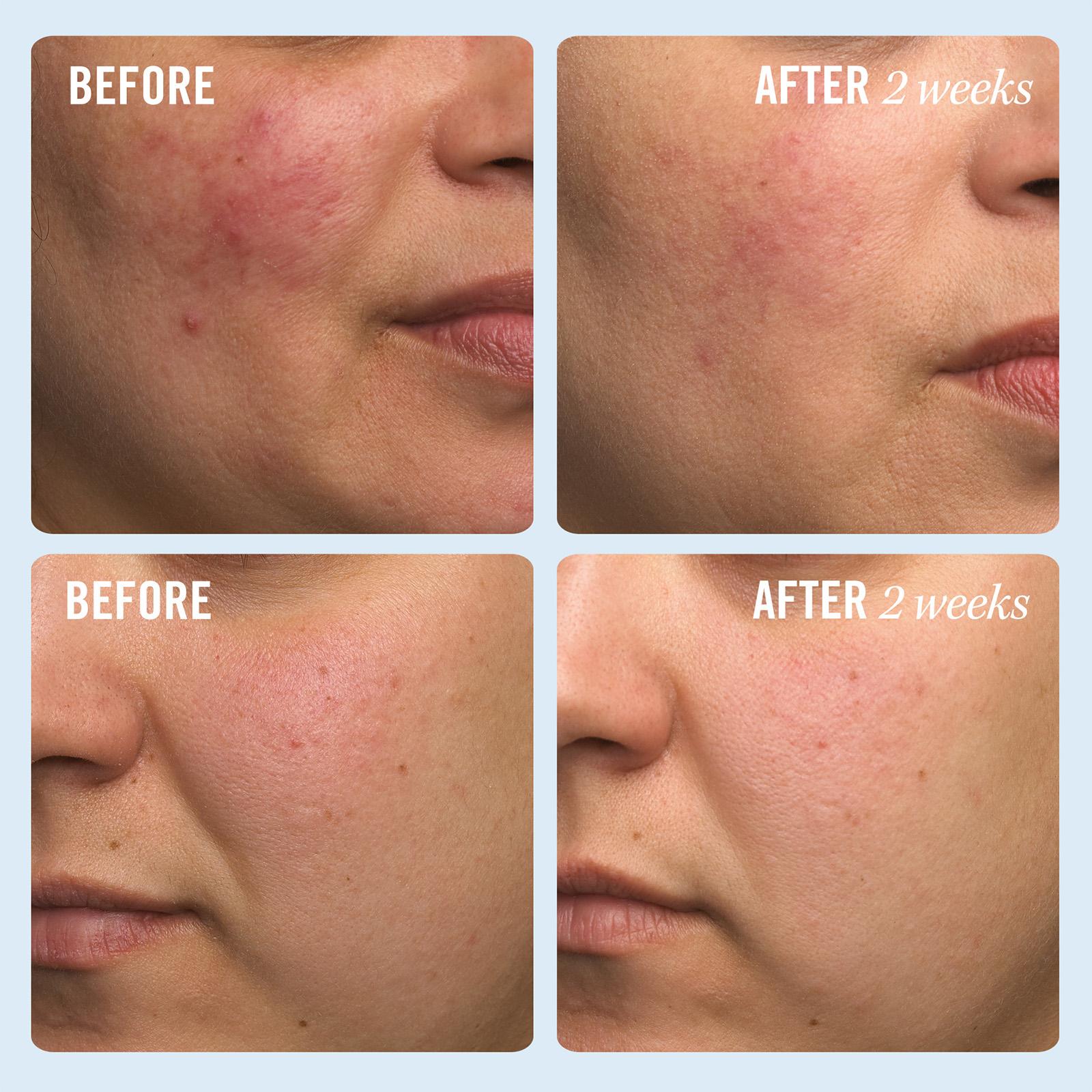 Ultra Repair Cream • 170.1 g