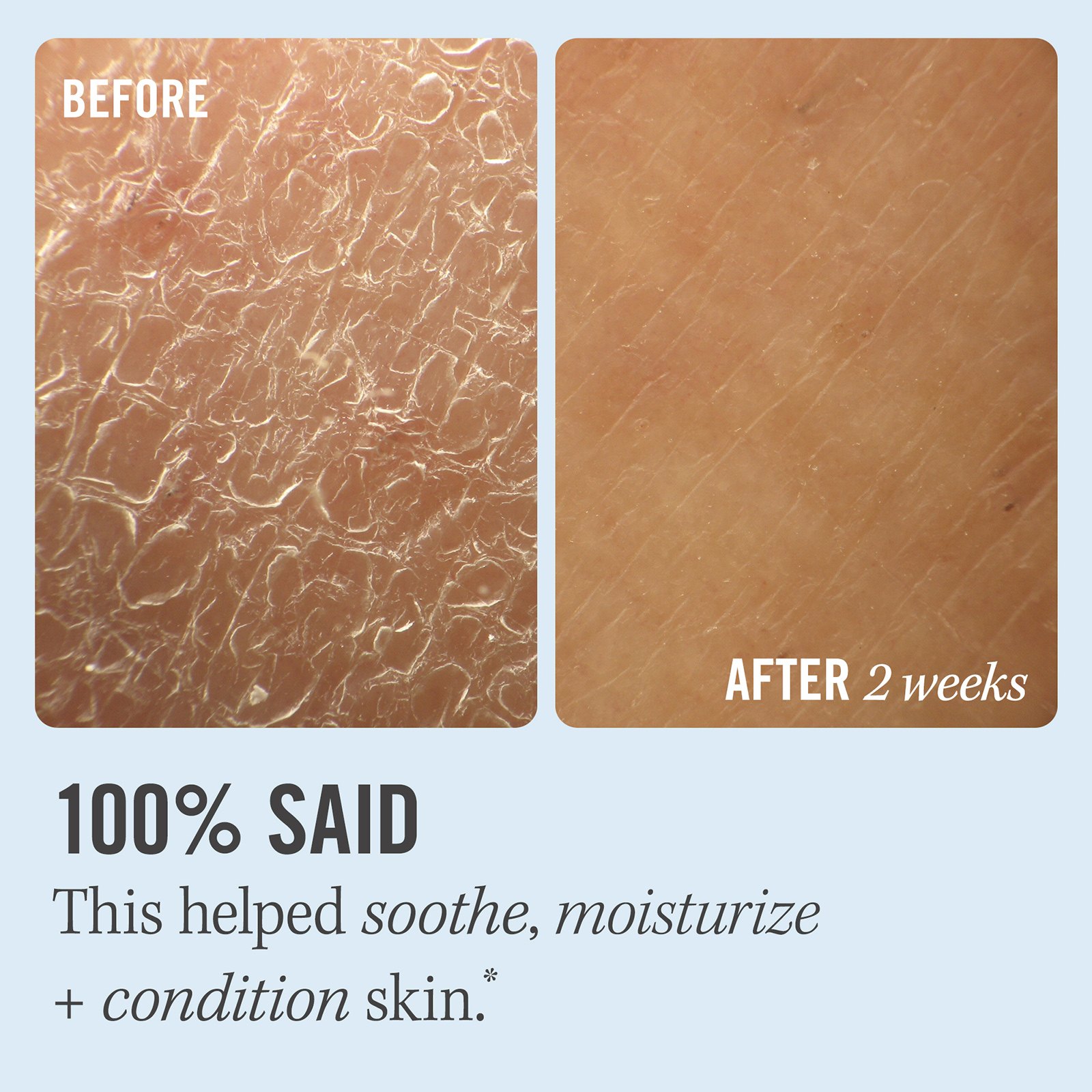 Ultra Repair Cream • 226.7g