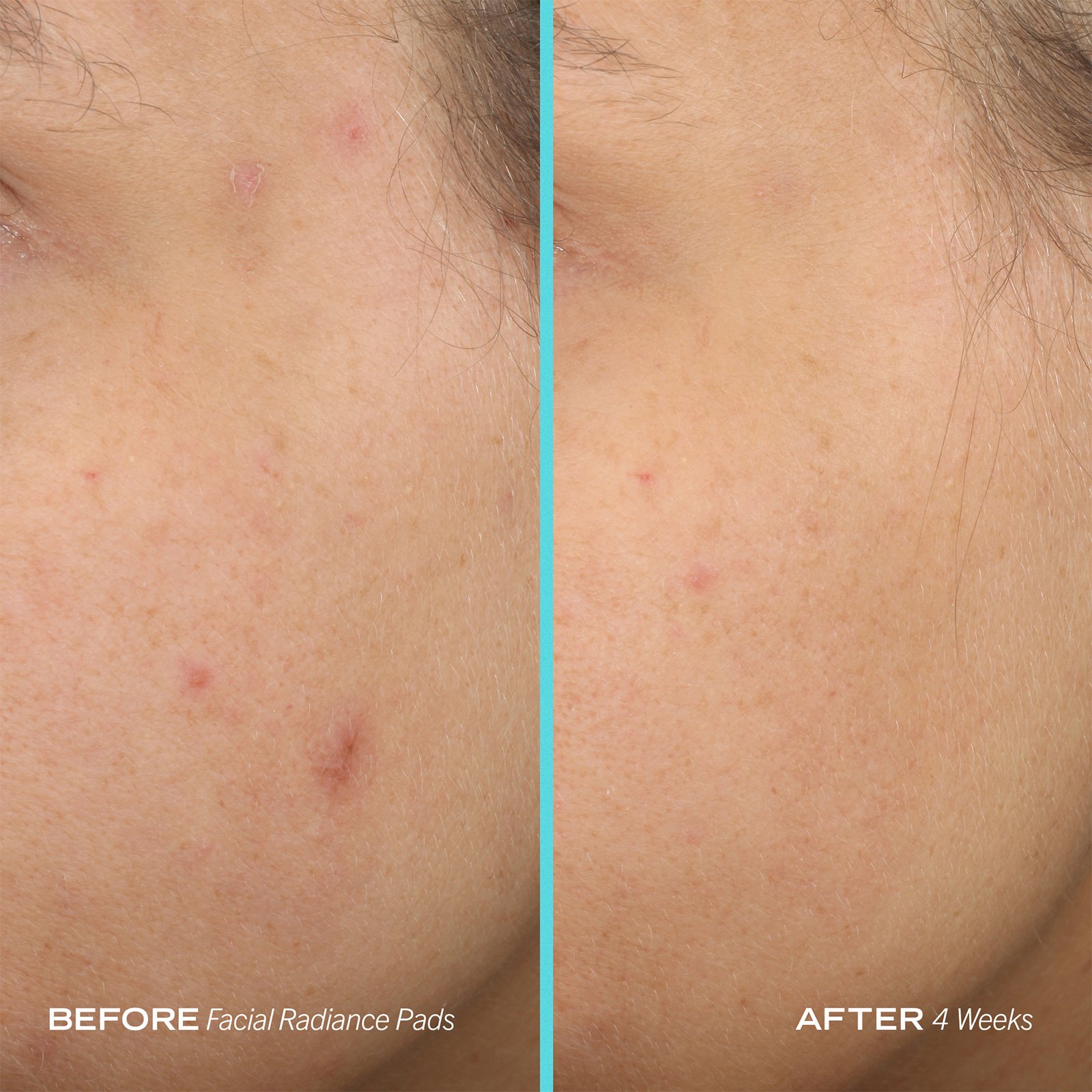 Facial Radiance Pads • 28 pads