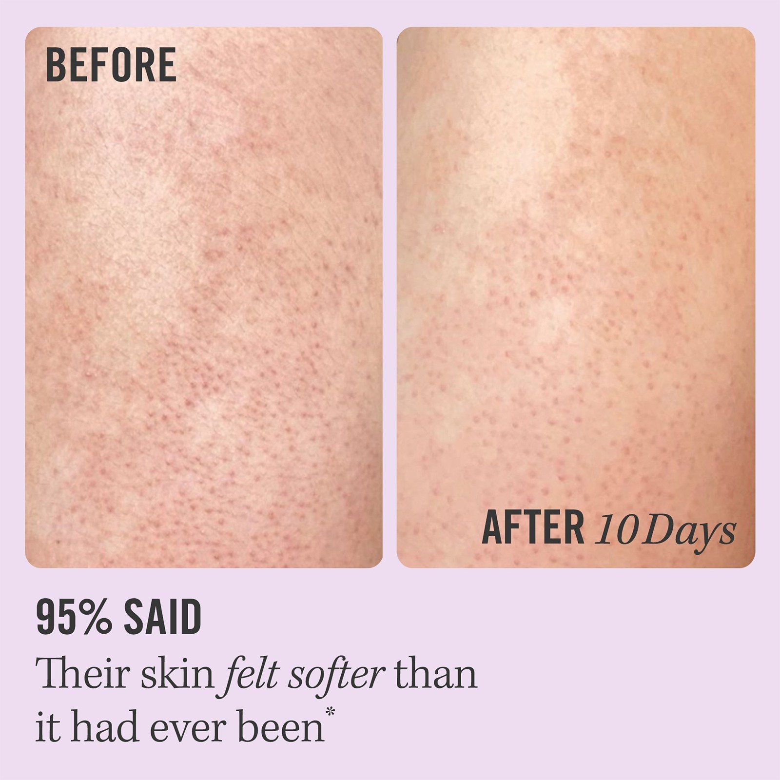 KP Bump Eraser Body Scrub with 10% AHA • 56.7g