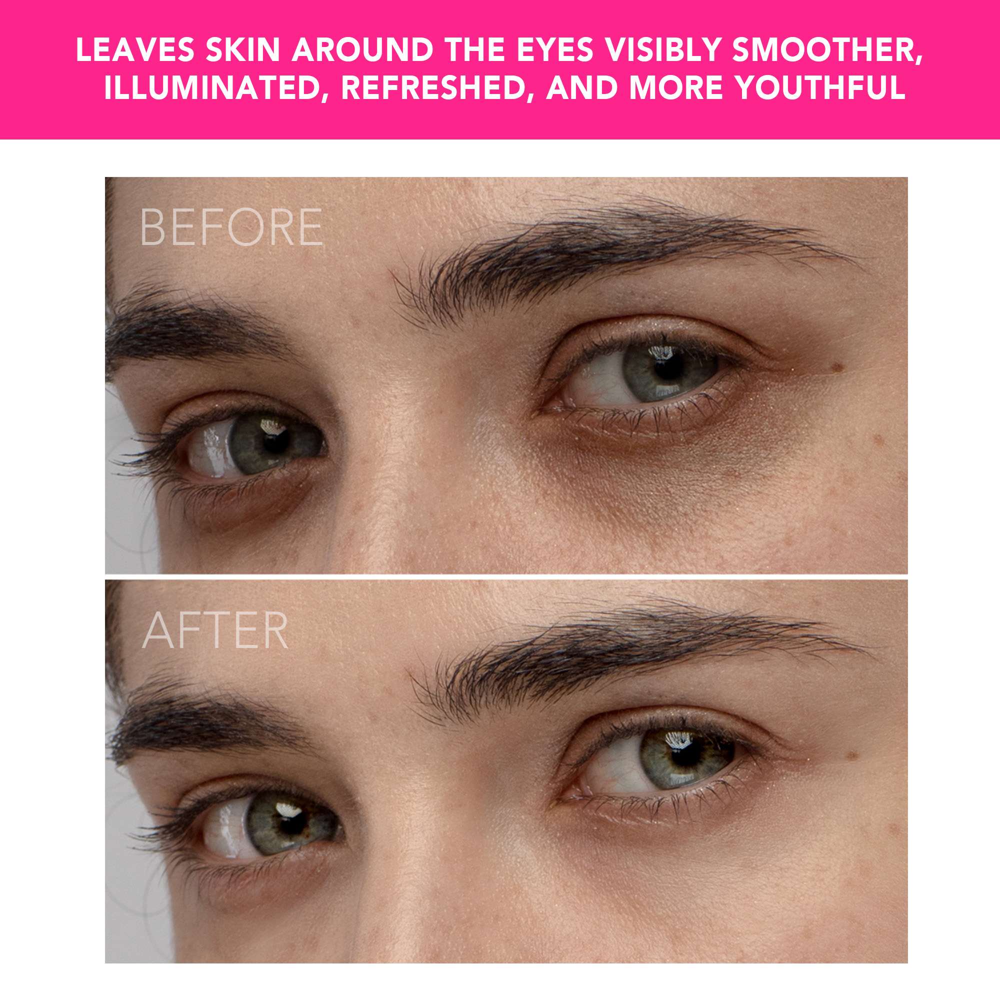 IRIS™ Illuminating Eye Massager • Magenta