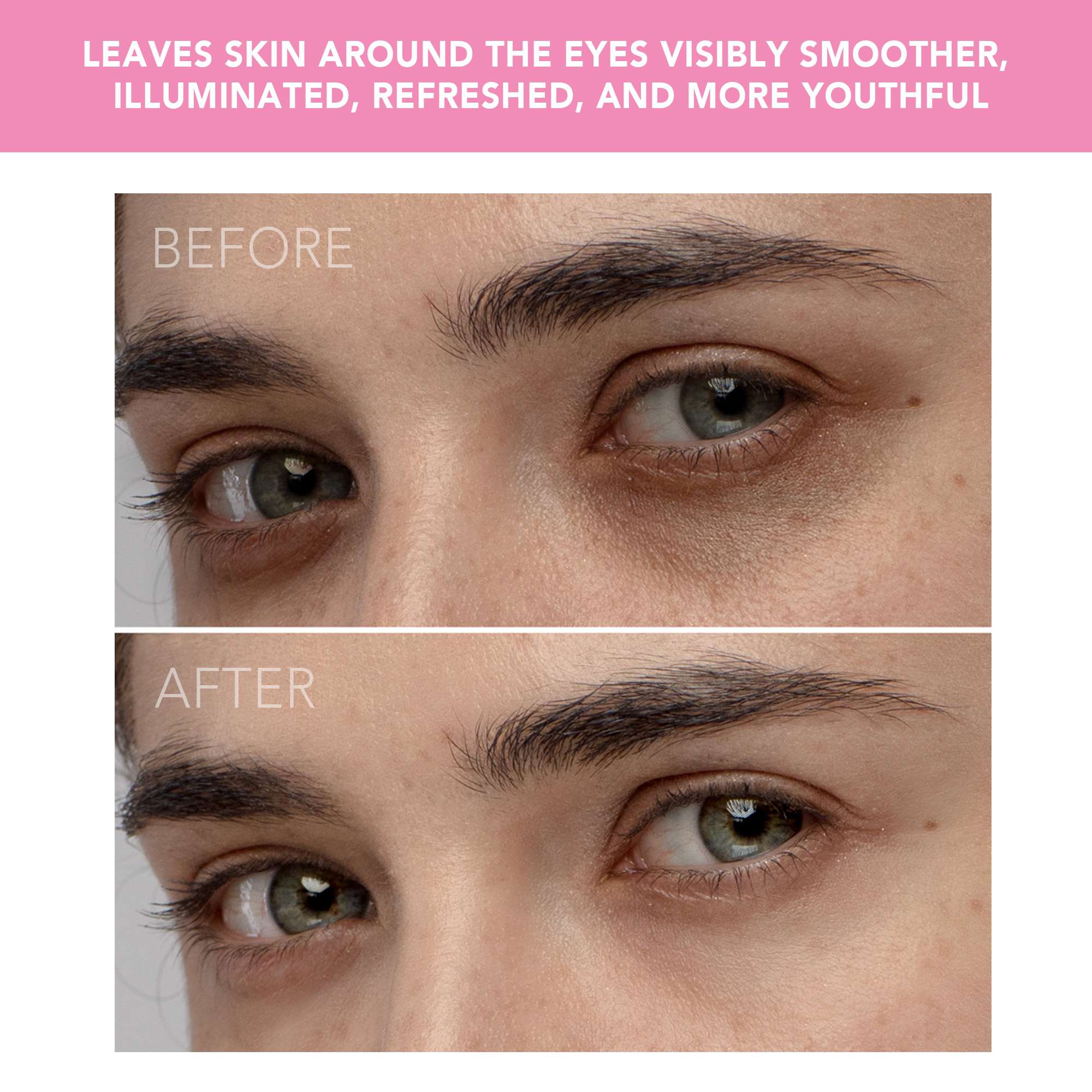 IRIS™ Illuminating Eye Massager • Petal Pink