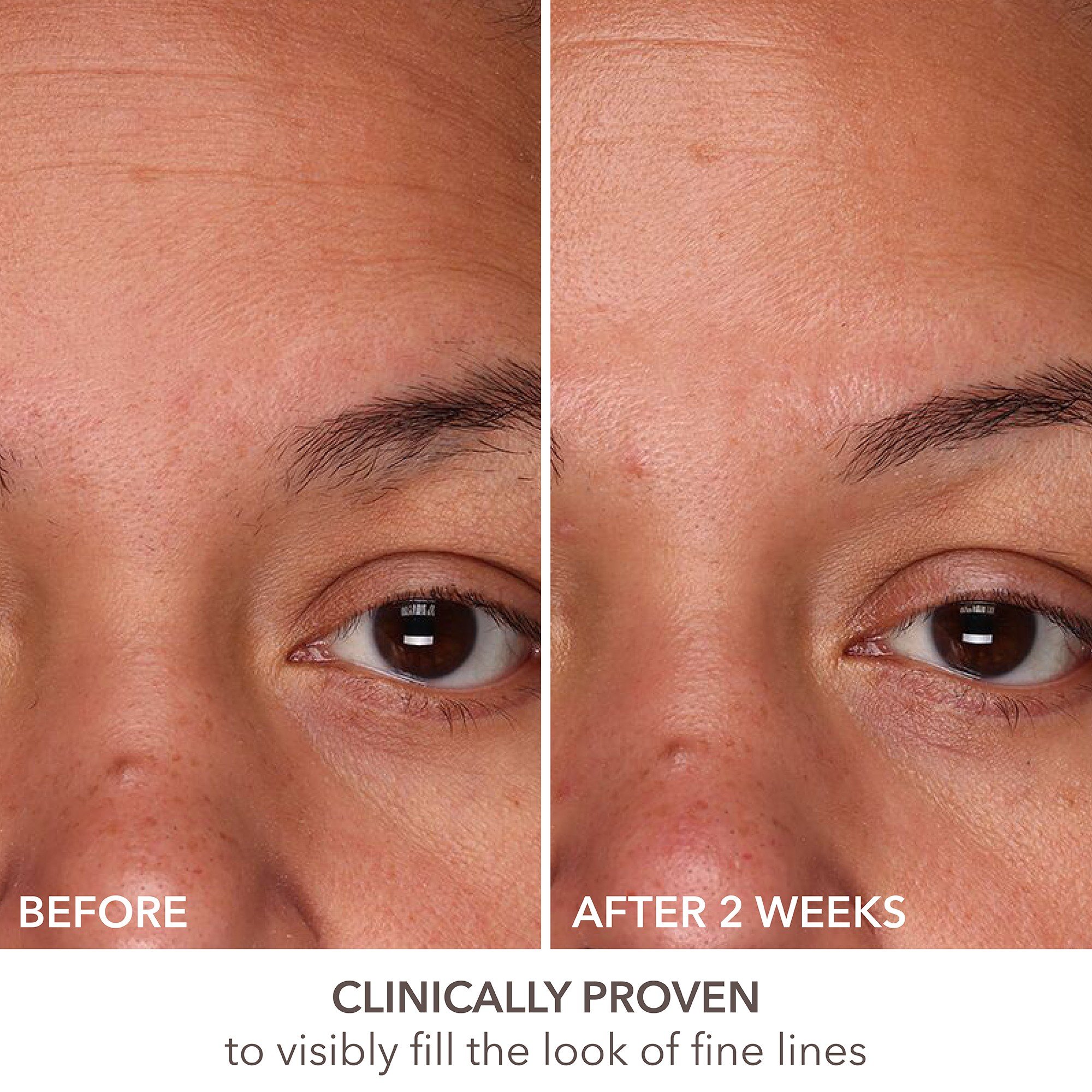 DermInfusions Fill + Repair Serum • 30g