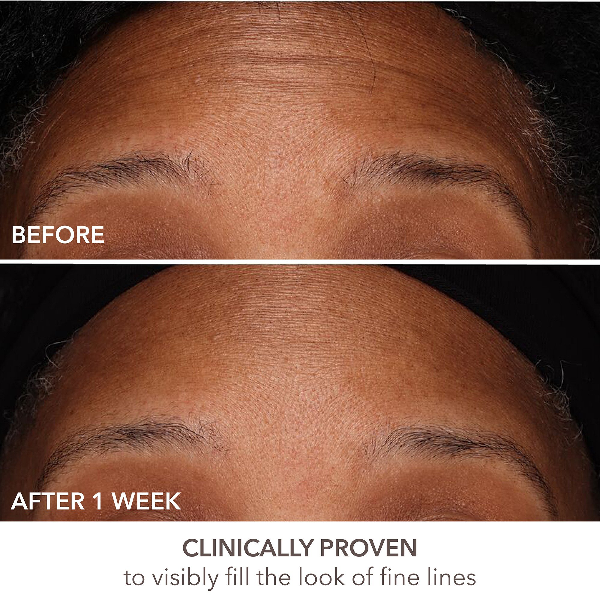 DermInfusions Fill + Repair Serum • 30g