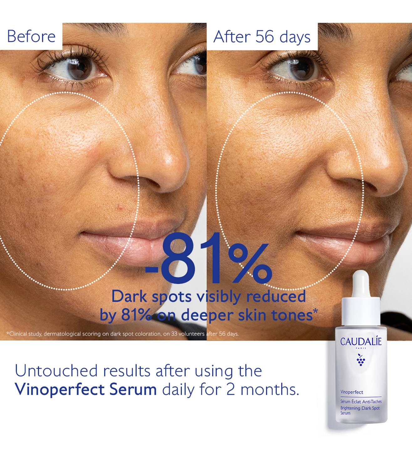 Vinoperfect Brightening Dark Spot Serum • 50ml