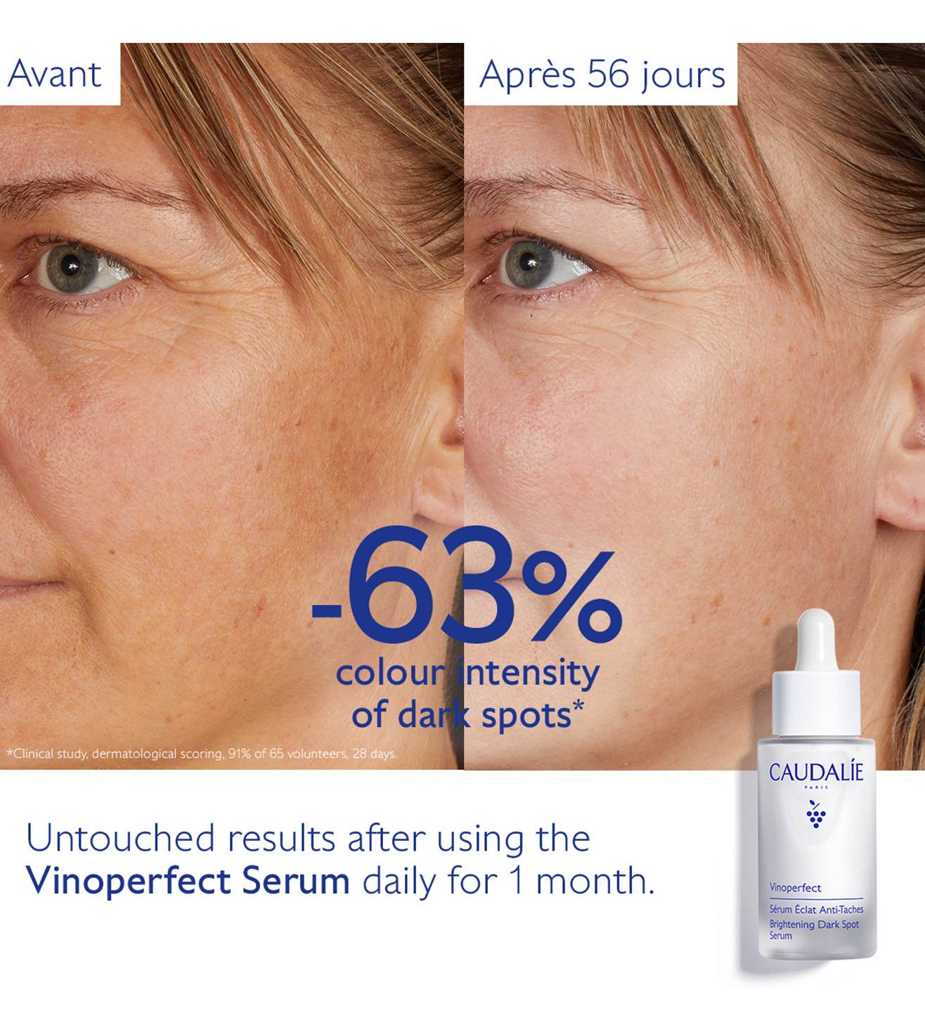 Vinoperfect Brightening Dark Spot Serum • 50ml