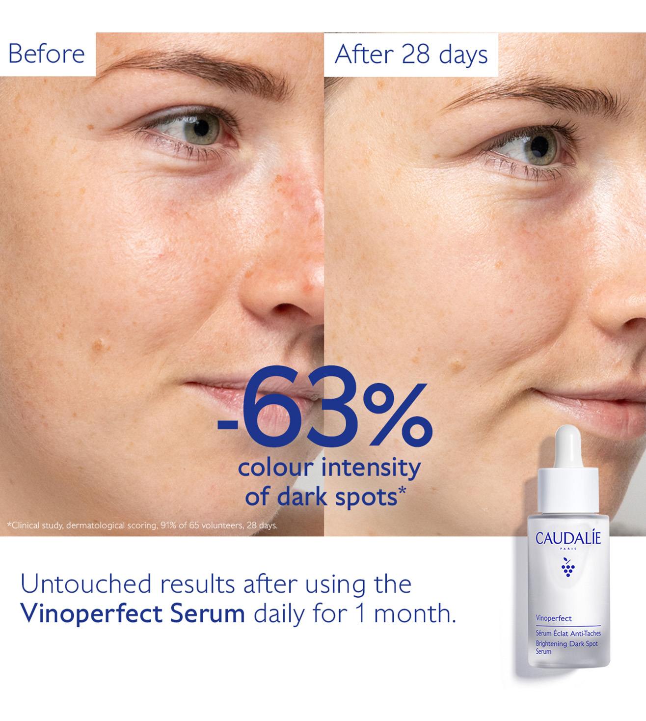 Vinoperfect Brightening Dark Spot Serum • 50ml