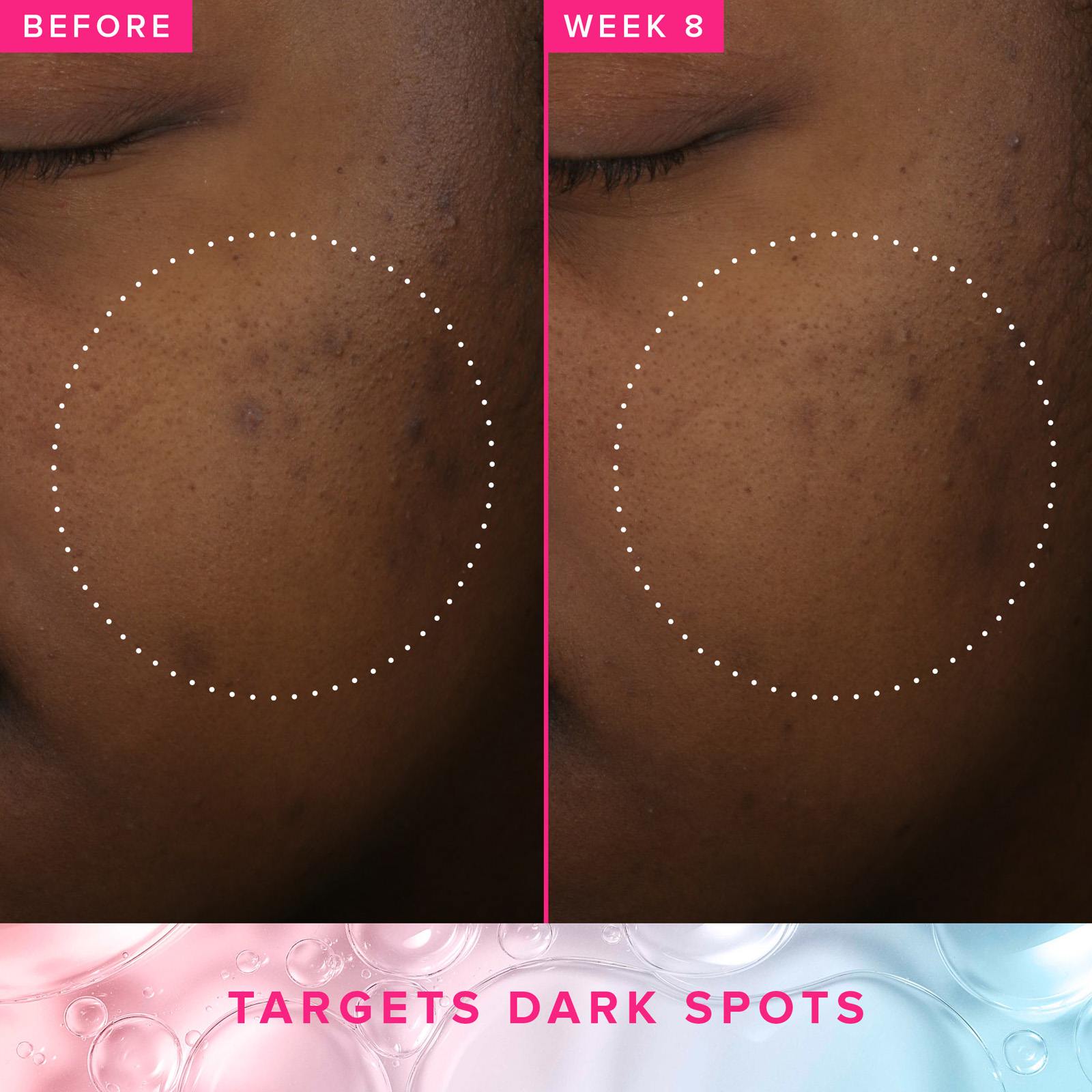 Brighten Up 3% TXA Dark Spot Toner • 120ML