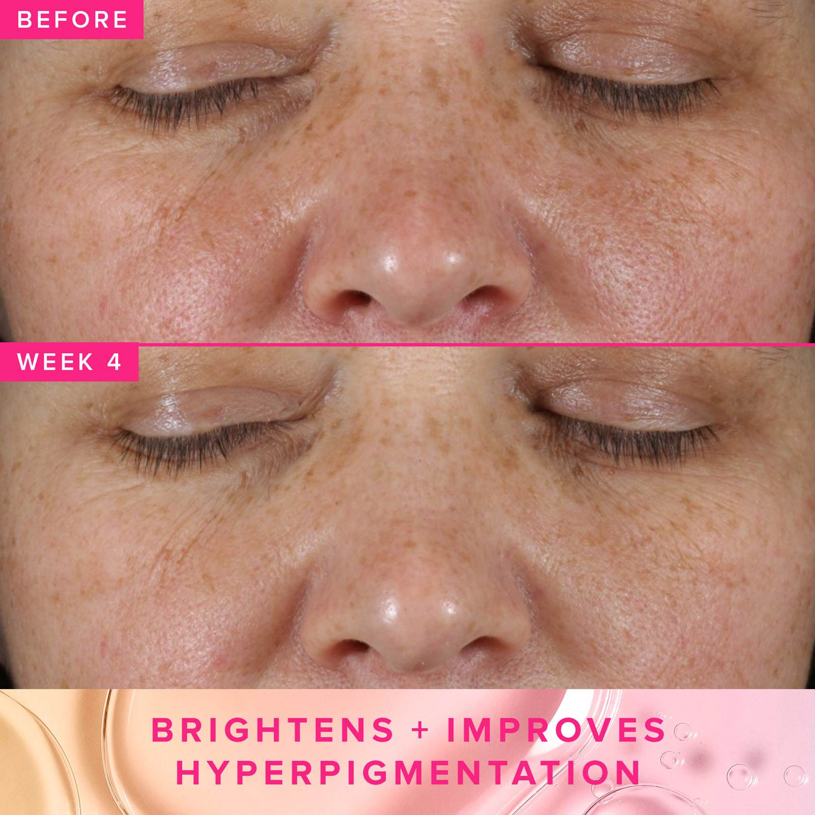 Brighten Up 3% TXA Dark Spot Toner • 120ML