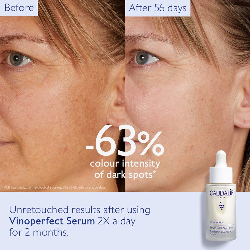 Vinoperfect Brightening Dark Spot Serum • 30ml