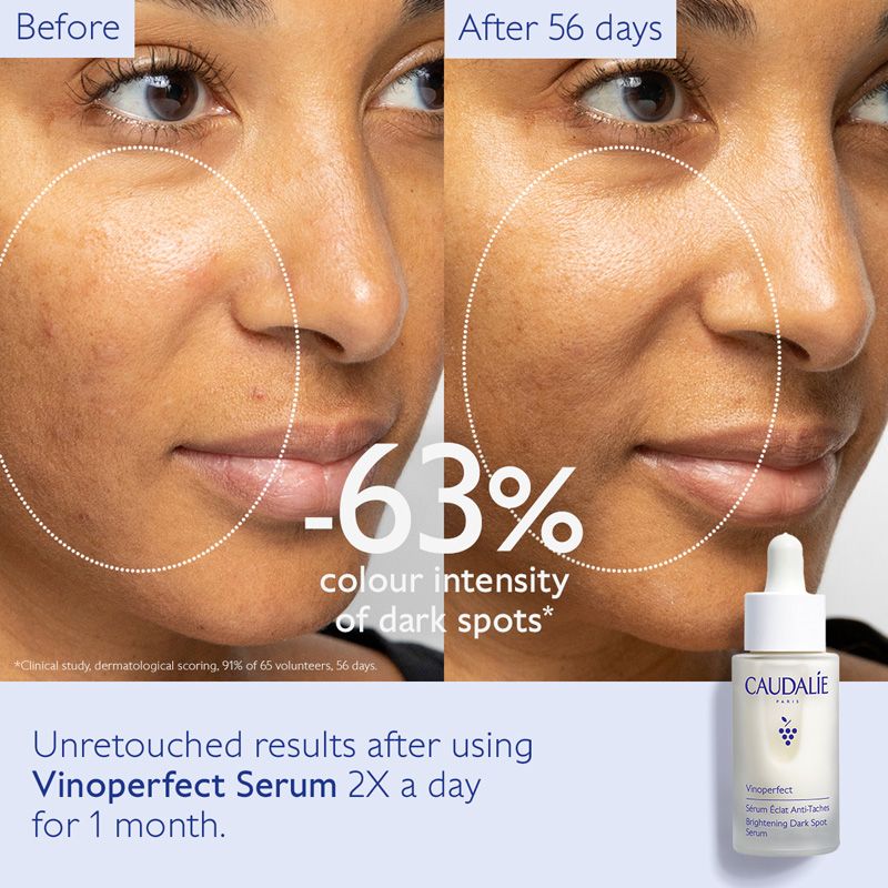 Vinoperfect Brightening Dark Spot Serum • 30ml