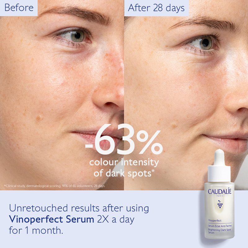 Vinoperfect Brightening Dark Spot Serum • 30ml