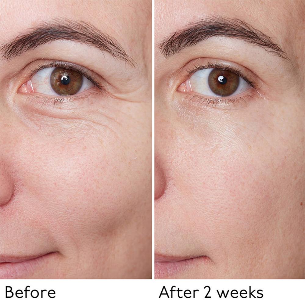 Hyaluronic Global Serum • 30mg