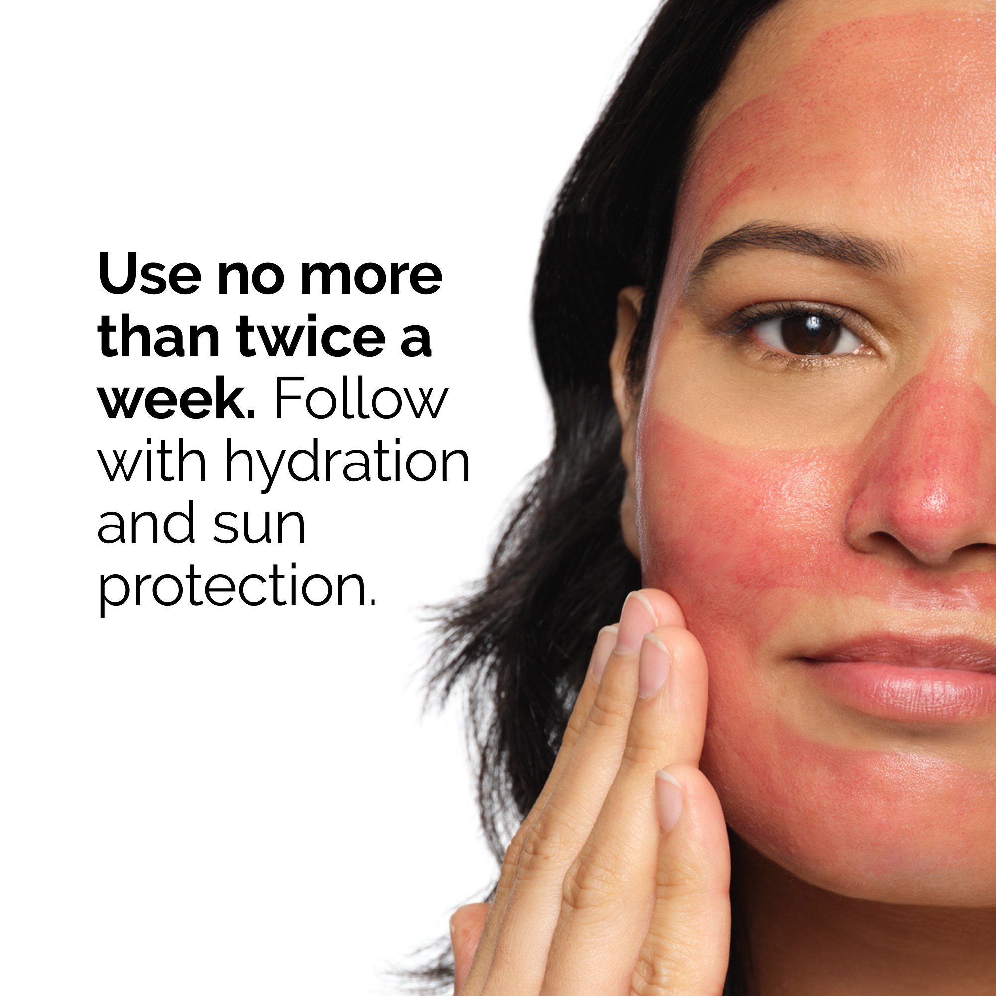 AHA 30% + BHA 2% Peeling Solution • 30ml