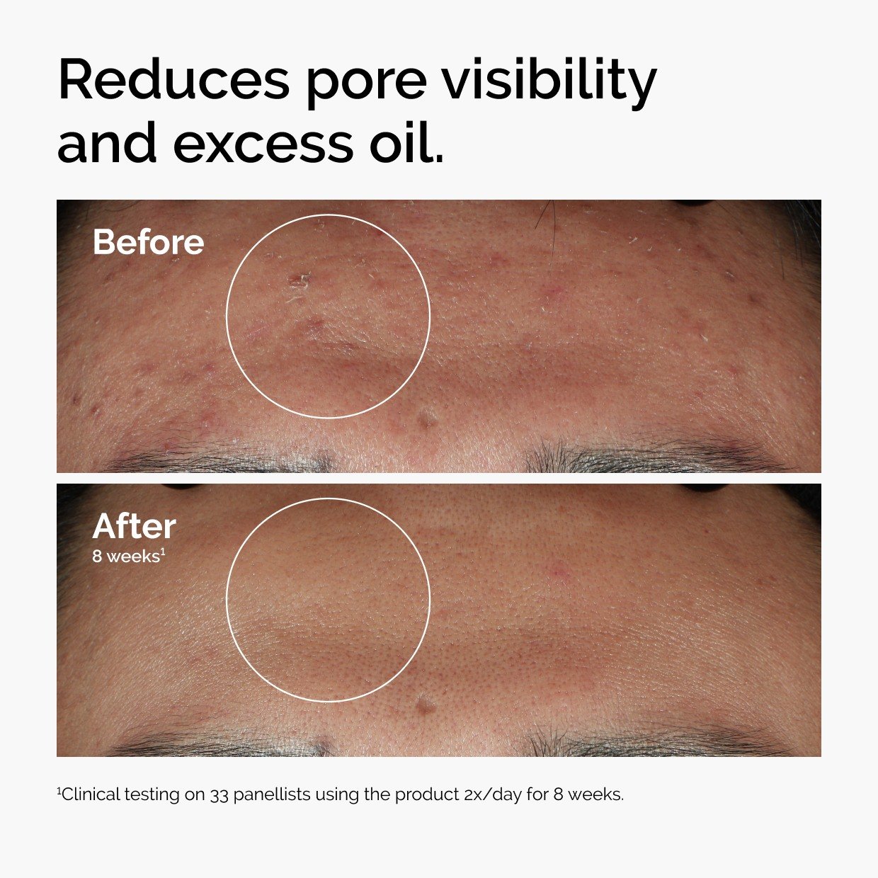 Niacinamide 10% + Zinc 1% • 30ml