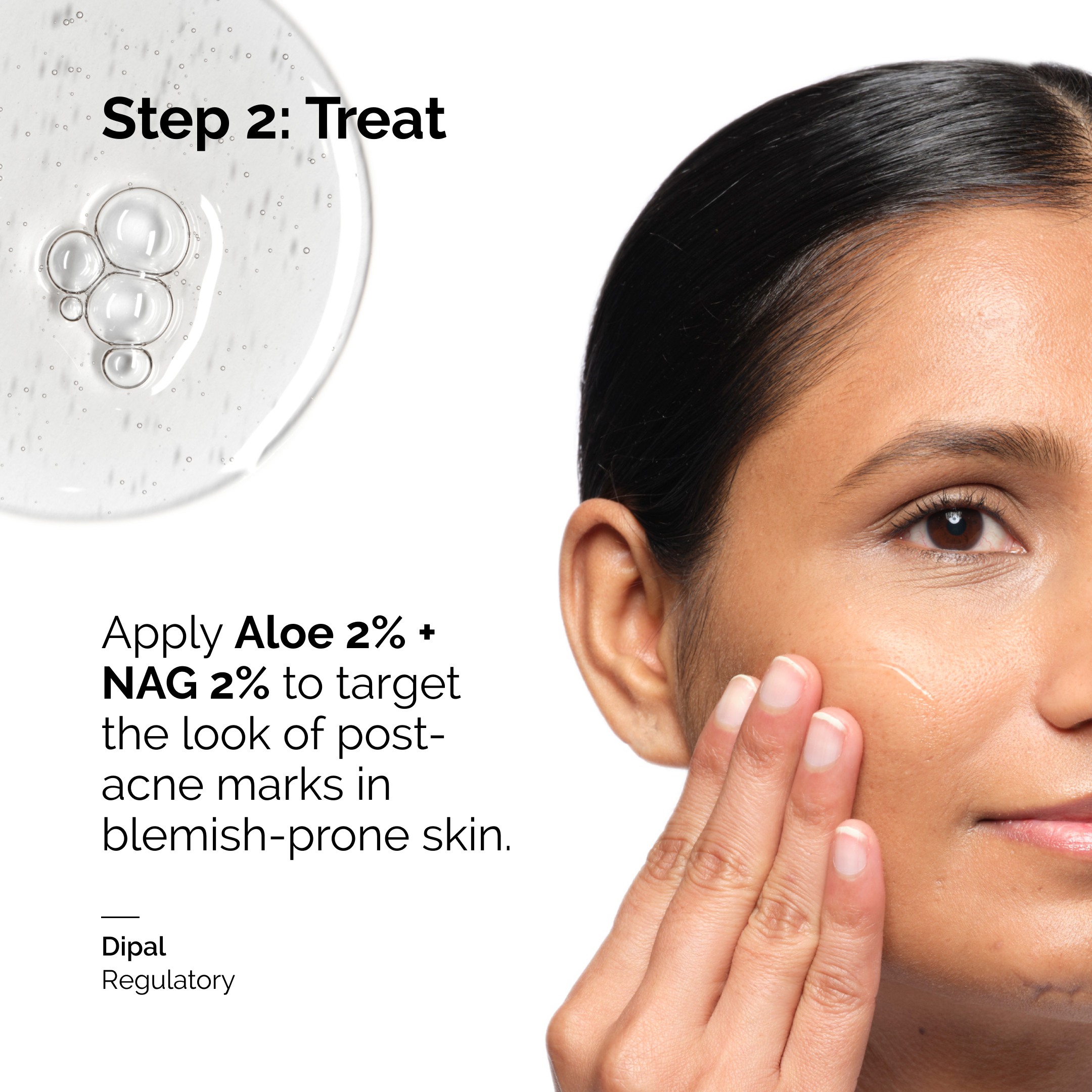 Aloe 2% + NAG 2% Solution • 30ml