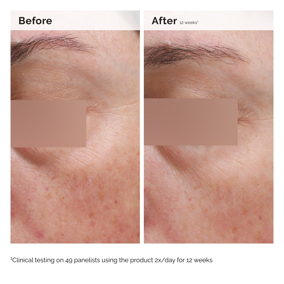 Niacinamide 5% Face & Body Emulsion • 100ml