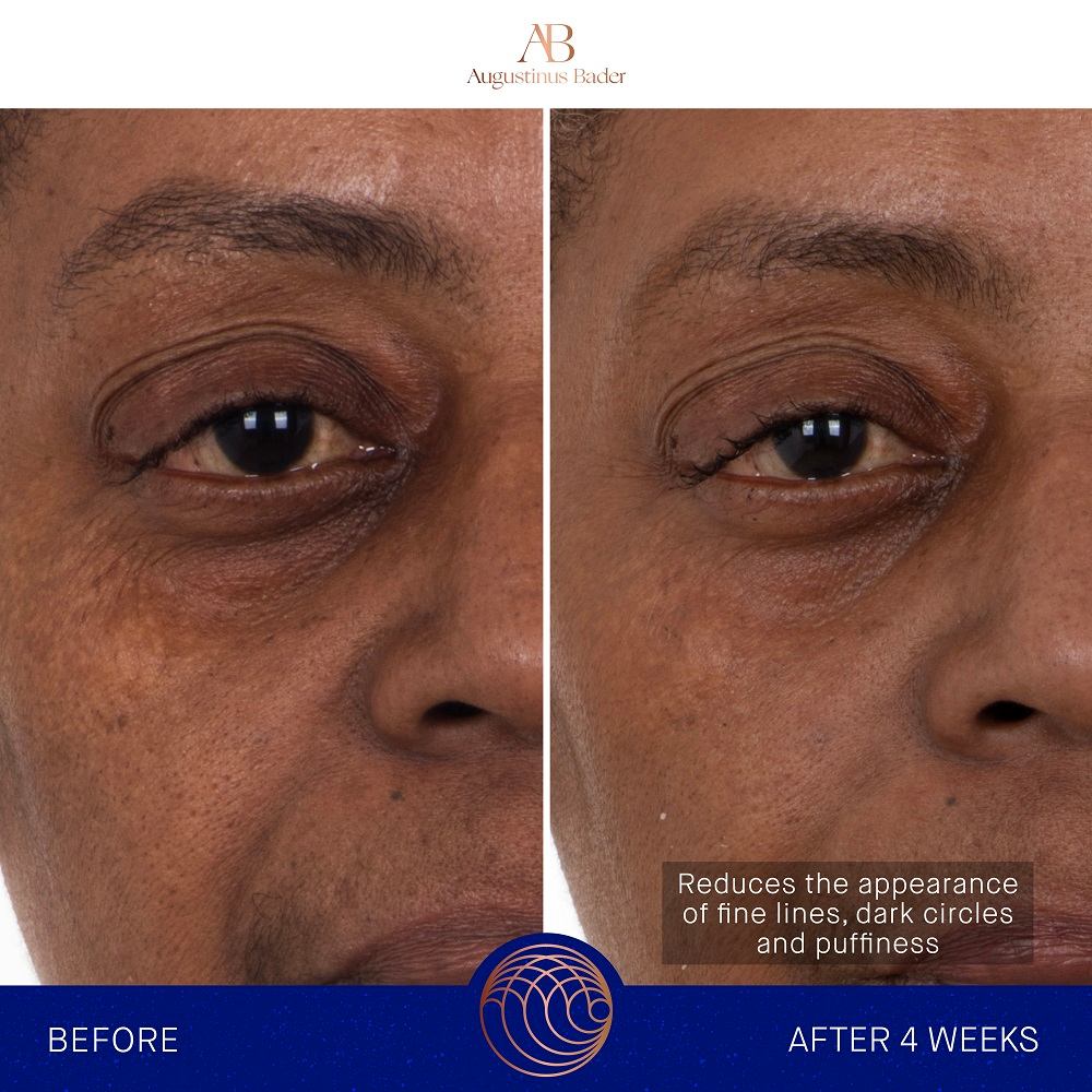 The Eye Patches With TFC8® Set