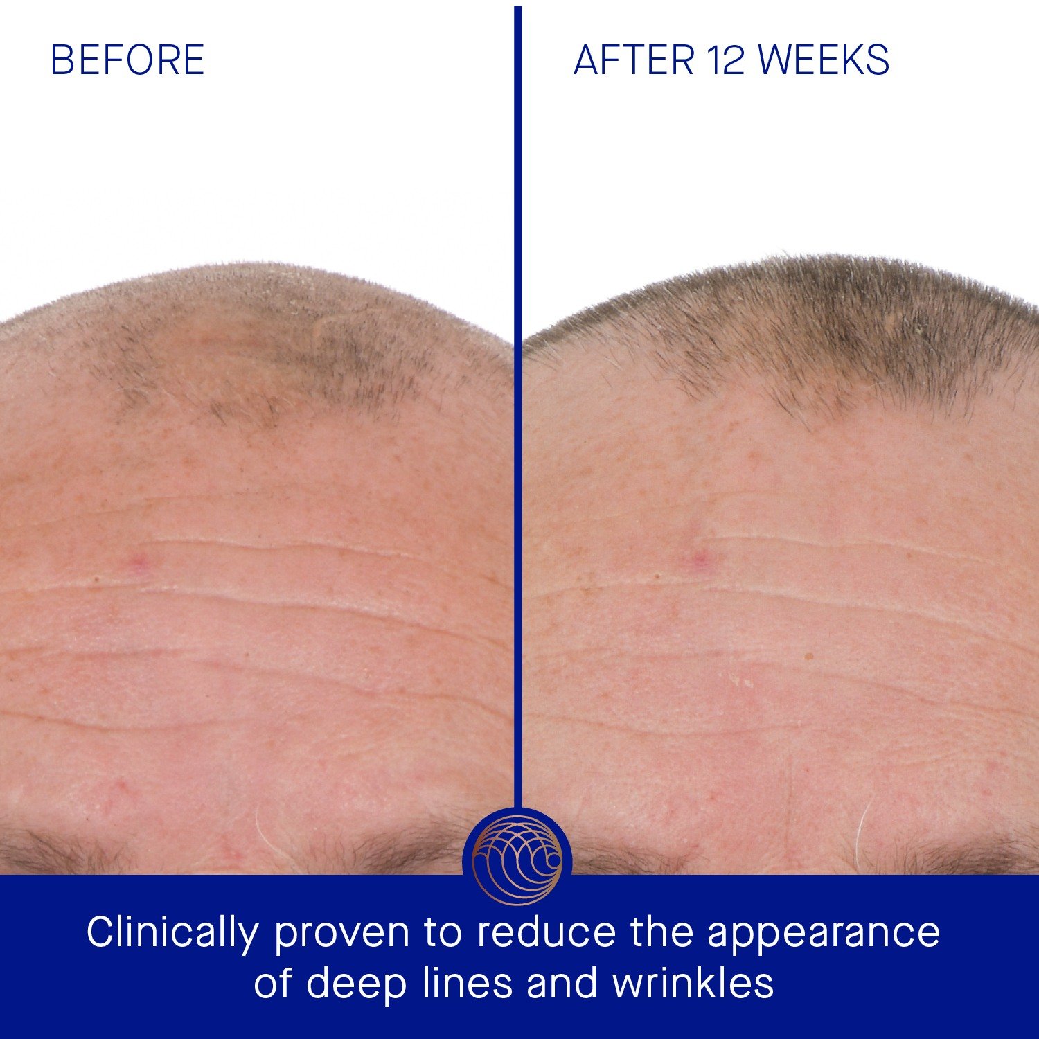 The Retinol Serum • 50ml