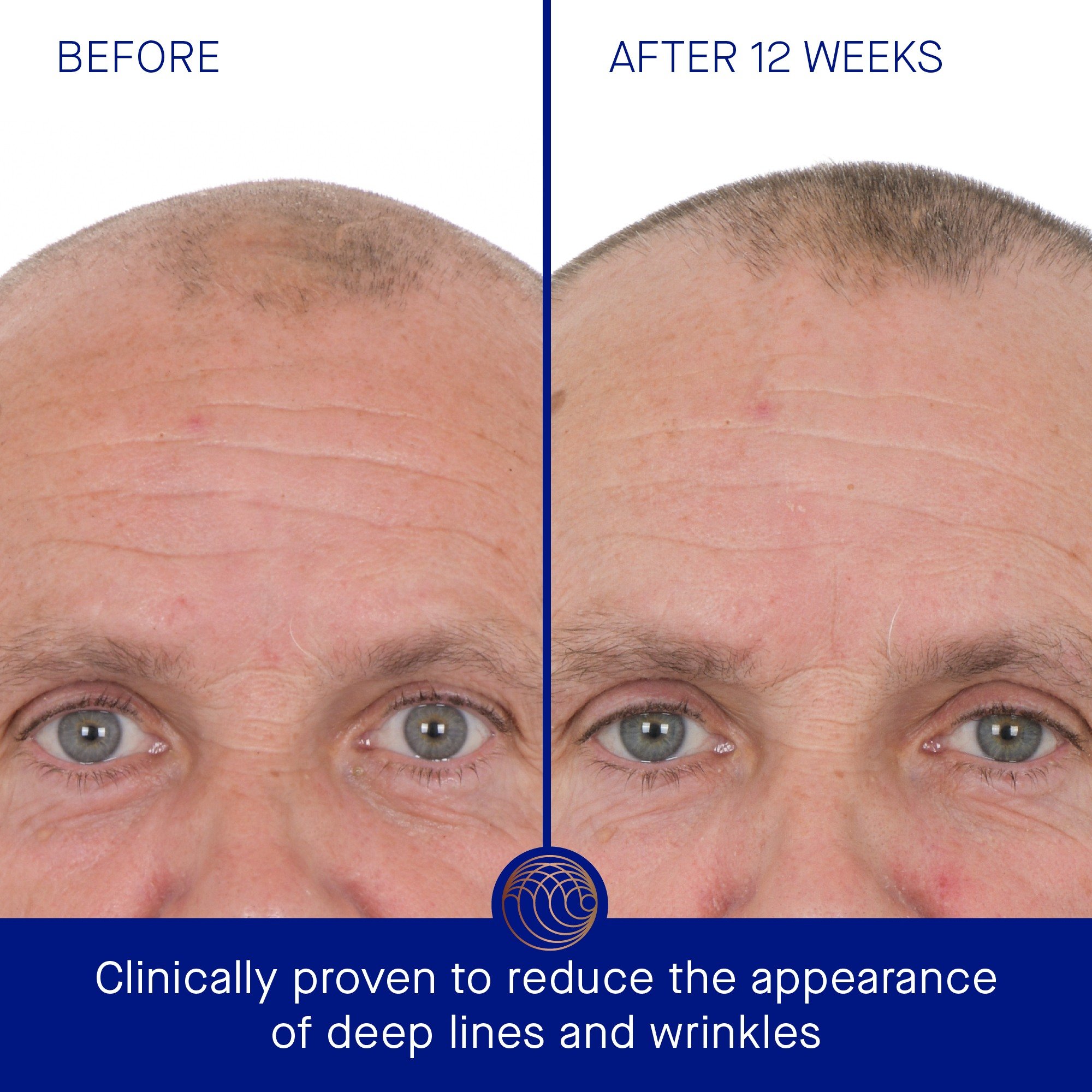 The Retinol Serum • 50ml