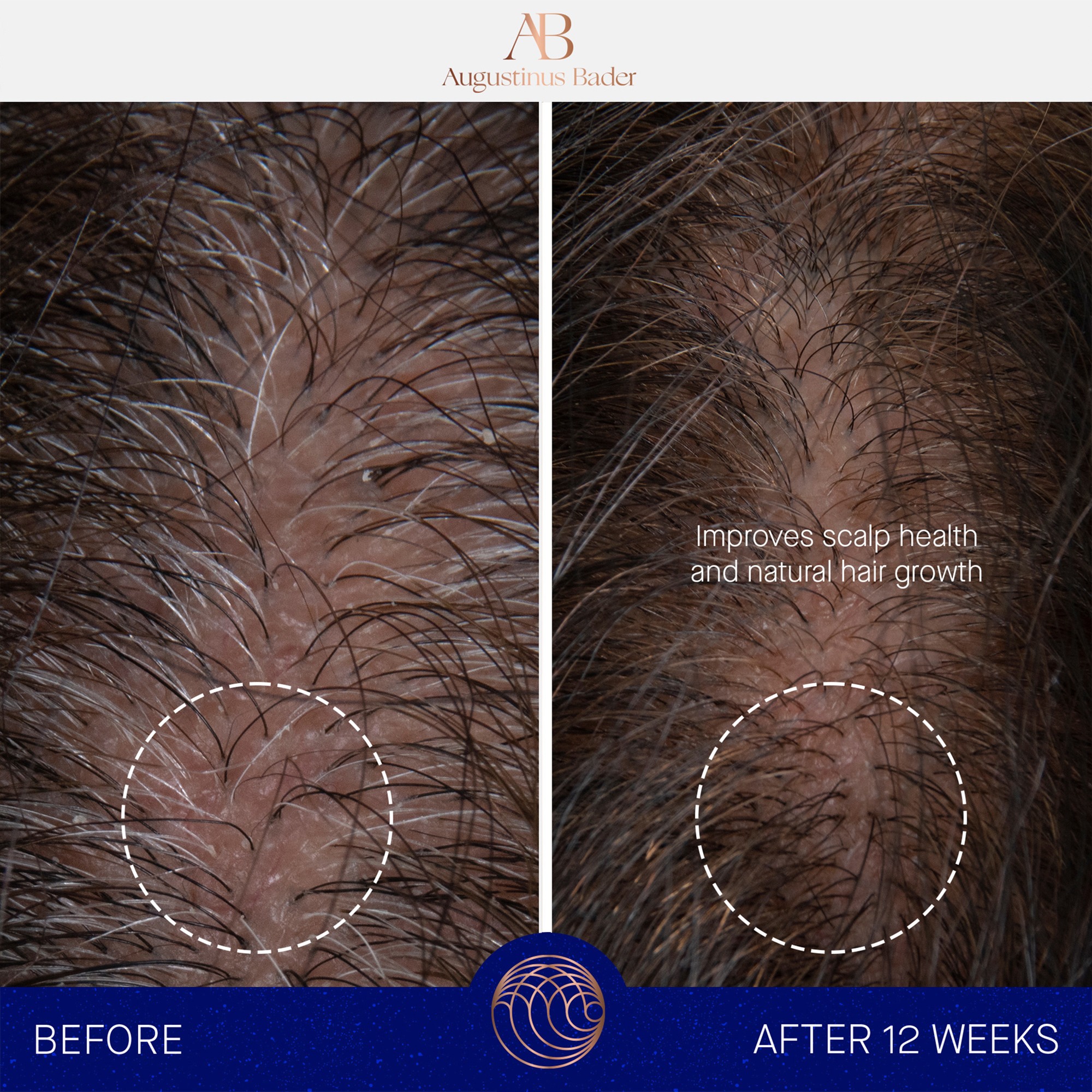 The Scalp treatment • 30ml
