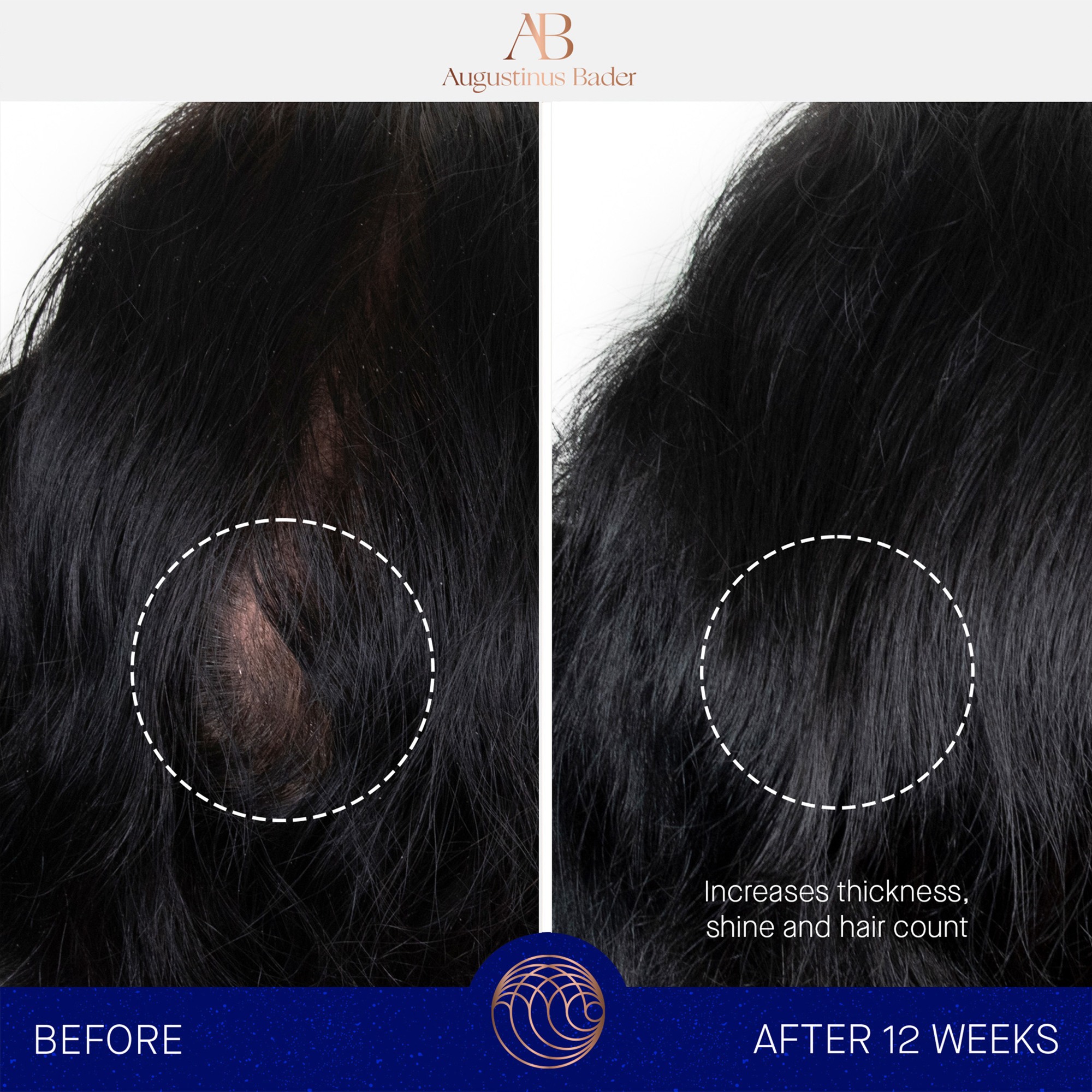 The Scalp treatment • 30ml