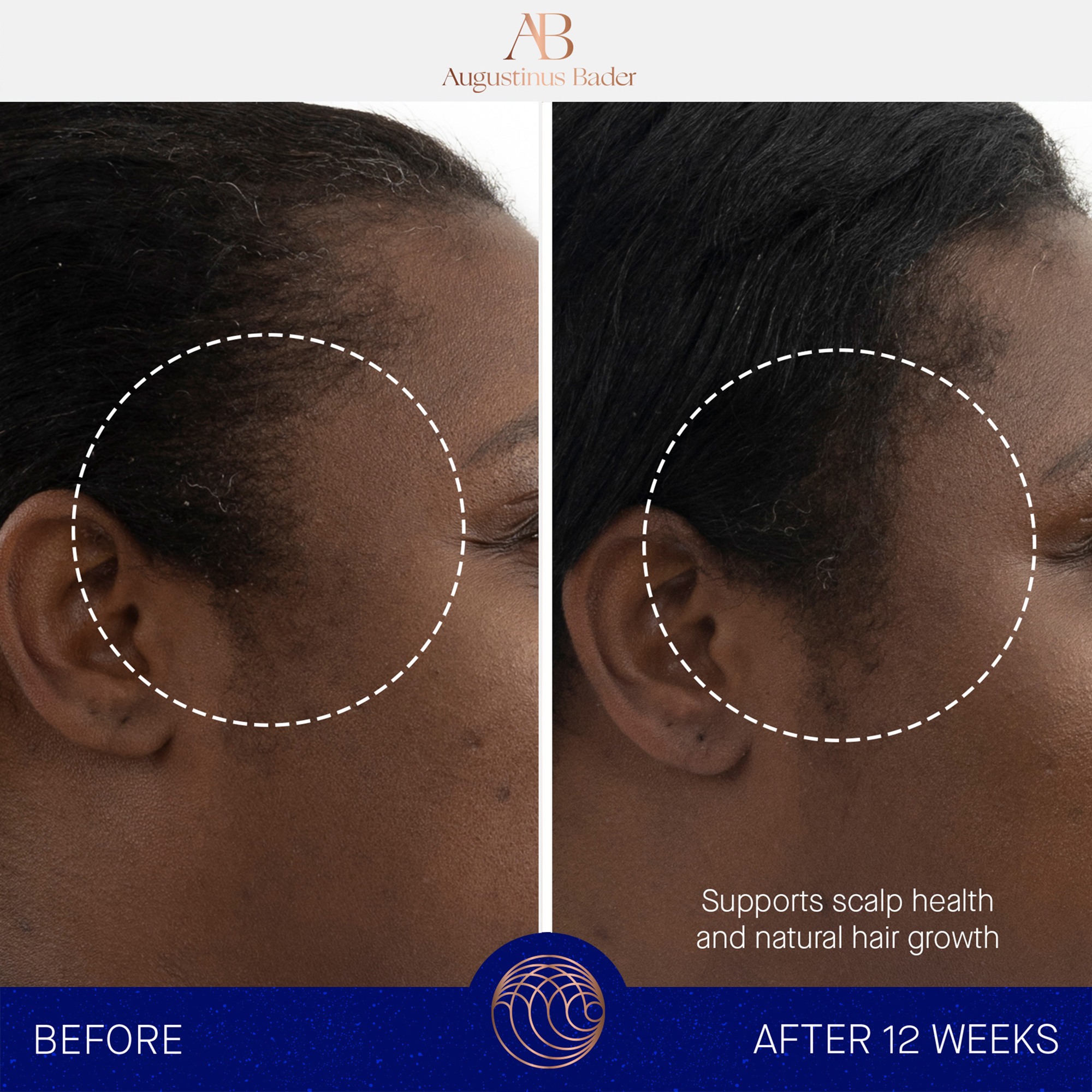 The Scalp treatment • 30ml