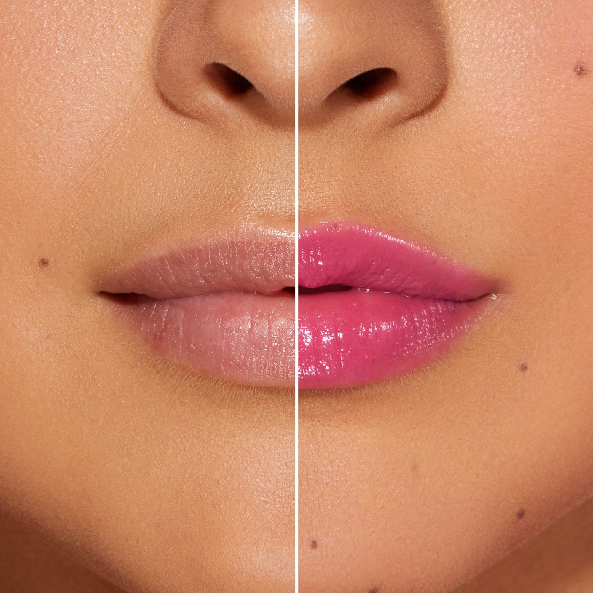 Lip Injection Extreme Plumping Clicks • Voted Most Popular