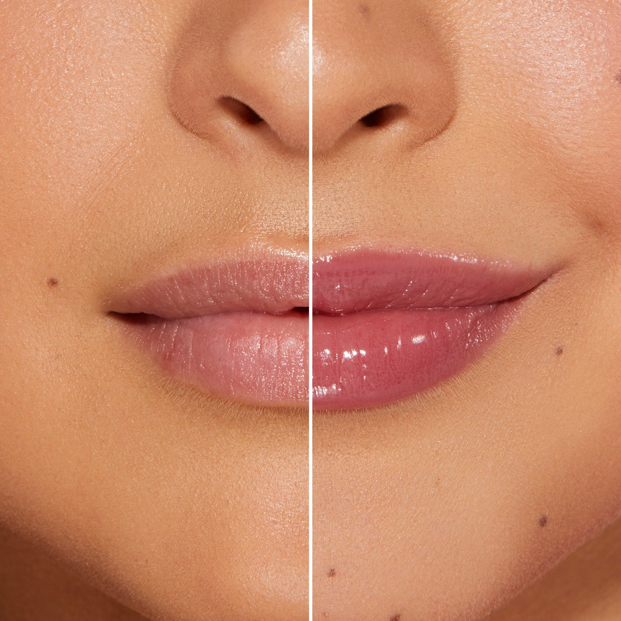 Lip Injection Extreme Plumping Clicks • Kiss The Bride