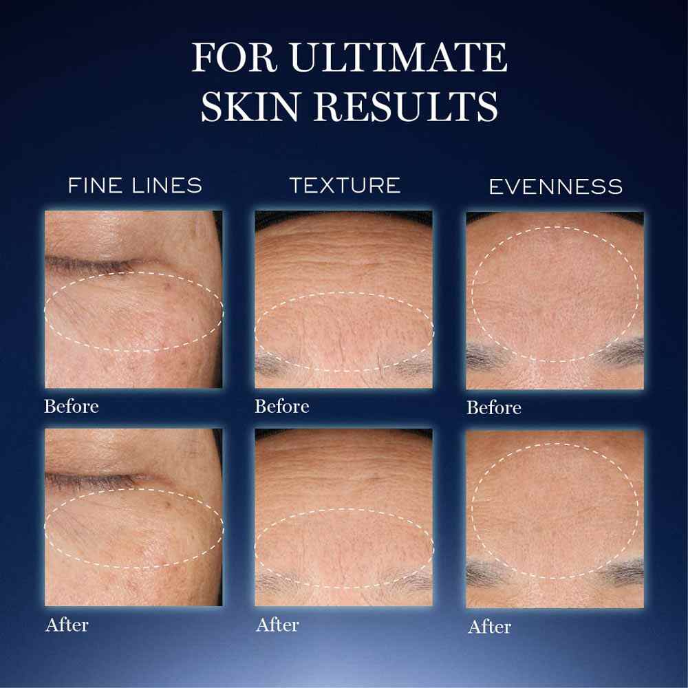 Genifique Ultimate Skin Repair Serum With Beta Glucan (Suited for Indian Skin) • 30ml