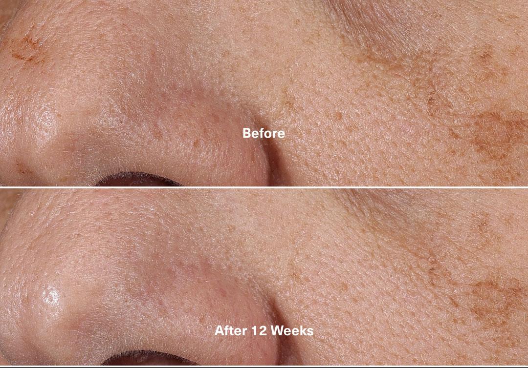 The New Rejuvenating Night Cream • 100ml